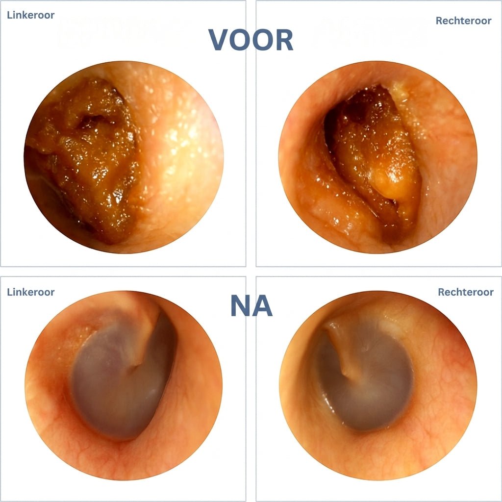 ClearEar Pro - Slimme Oorreiniger - Image 3